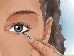 how to get rid of a stye 11 steps