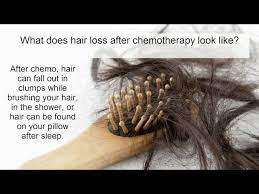 hair loss from chemotherapy what is it