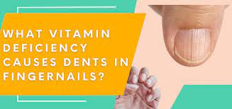 what vitamin deficiency causes dents in
