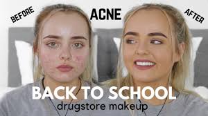 natural acne coverage