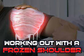 frozen shoulder working out a how to