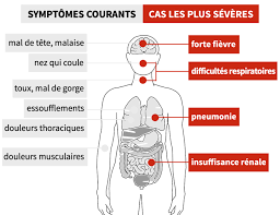 Symptômes, causes, traitements, transmission, reconfinement. Les Symptomes Orl Du Coronavirus Etat Des Connaissances Actuelles