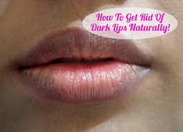 how to get rid of dark lips naturally