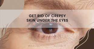 crepey skin under the eyes
