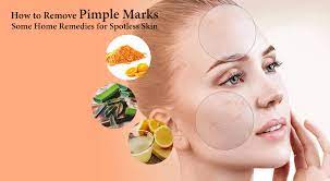 how to remove pimple marks some home