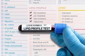 your guide to cholesterol testing