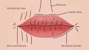 lip lines castleknock cosmetic clinic