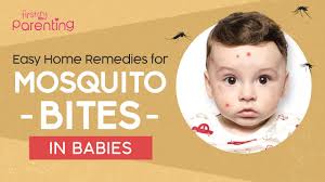 home remes for mosquito bites