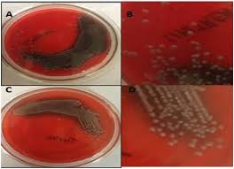 All strains were examined both for the presence of icaa and icad genes responsible for slime synthesis by a pcr method and for the in vitro slime production ability by the congo red agar (cra) plate test. Frontiers A Novel Approach For Combating Klebsiella Pneumoniae Biofilm Using Histidine Functionalized Silver Nanoparticles Microbiology
