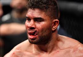 Why would anyone want cauliflower ear when it's so easily avoided? Ufc Ace Alistair Overeem Suffers Horrific Injury As Lip Goes Flying Through The Air In Loss To Jairzinho Rozenstruik