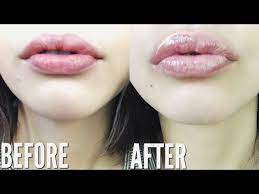 how to get bigger lips naturally