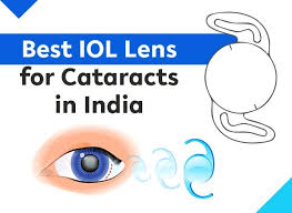 best iol lens for cataracts in india