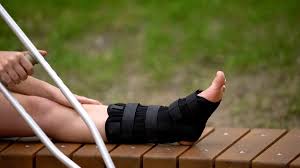 an ankle fracture recovery