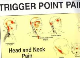 Trigger Point Pain Patterns Wall Charts Janet G Travell