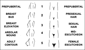 Tanner Scale For Categorizing Pubertal Breast Development