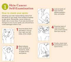 Skin Cancer Self Exam Mole Chart The Dr Oz Show