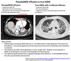Has mortality from ards decreased over time? Pulmcrit Ards Vs Pseudoards Failure Of The Berlin Definition
