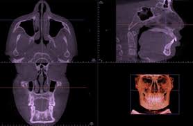 an introduction to reviewing cbct images