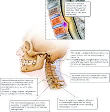 The neck begins at the base of the skull and connects to the thoracic spine (the upper back). Advances In The Diagnosis And Management Of Neck Pain The Bmj