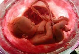 حكم تحديد جنس الجنين ابن عثيمين - حكم تحديد نوع الجنين بالحقن المجهري -  معلومة