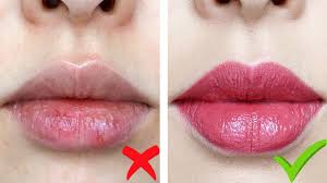 how to get rid of dry chapped lips