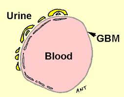 glomerular basement membrane disorders