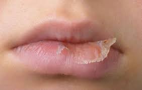 3 common lip balm ings that