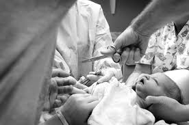cutting the umbilical cord after birth