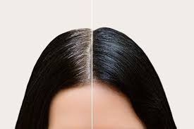 Women are starting to own their white hair in big and beautiful ways. Why Do We Get Gray Hair Causes And Home Remedies Healthzigzag