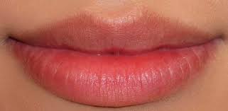 dark lips treatment natural remes