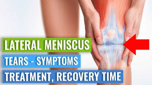 lateral meniscus tears symptoms
