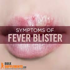 fever blisters causes symptoms