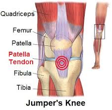 Common Causes Of Knee Pain