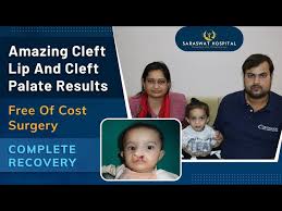 free cleft lip and palate surgery