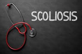 Understanding scoliosis & the signs to watch for | HealthyU