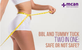 Sleeping after a tummy tuck surgery is possible regardless of how much fat was removed or the number stitches needed to cover up the incisions. Bbl And Tummy Tuck Two In One Safe Or Not Safe Mcan Health