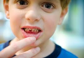 Check spelling or type a new query. Losing Baby Teeth How To Get Your Most Stubborn Kids To Pull Their Own Teeth Erica R Buteau