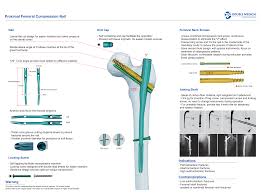 pfcn proximal fem compression nail