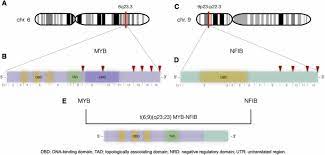 myb nfib fusion transcript in adenoid