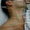 The lymph nodes closest to the throat are on either side of the neck. Https Encrypted Tbn0 Gstatic Com Images Q Tbn And9gcr4zukehmicdabi8 Rdbqmufnjqcmrmi2dewvb5 4ir4 Wroy7j Usqp Cau