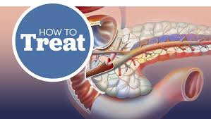 exocrine pancreatic insufficiency in