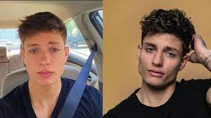Matt Rife's Plastic Surgery: Did The Comedian Have a Glow-Up or Did He Get  Cosmetic Procedures? | Plastic surgery, Celebrity plastic surgery, Facial  fillers