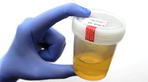 urinalysis urine description sg and