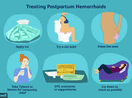 There are different surgical procedures to extract the blood clot from the vein of the thrombosed hemorrhoid. Hemorrhoids After Giving Birth At Home Treatments