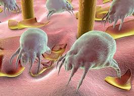 treatment of dust mite allergies