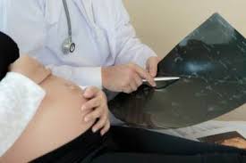 Gambaran usg janin perempuan usia kehamilan 29 minggu 3 hari youtube. Bingung Membaca Hasil Usg Jenis Kelamin Janin Begini Caranya