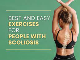 with scoliosis