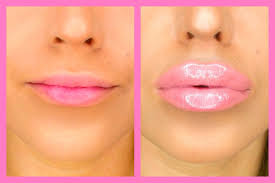 get fuller lips naturally fashion in