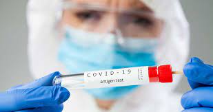 test antigena i dijagnoza covid 19