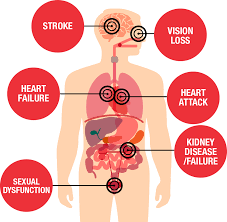 Health Threats From High Blood Pressure American Heart